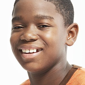 EnsuretheBestOutcomewiththeRightCareforaTeensMissingTooth